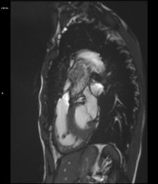 2017 11 14 20 10 2402 2017 11 13 Mri Insider Pic3 225