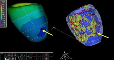 2017 11 17 17 23 6515 2017 11 17 Adv Fig2 709