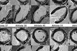 2017 11 21 00 12 2293 Rsna Triathletes Starekova 1406 20171121004846