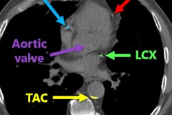2017 12 11 21 35 0015 Lessmann1 20171211214505