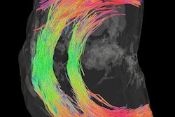 2017 12 21 19 17 0733 2017 12 22 Mri Cervix Bjog 20171221194749