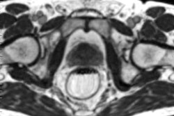 2017 12 22 19 16 4516 2017 12 26 Mri Linac 20171222190322