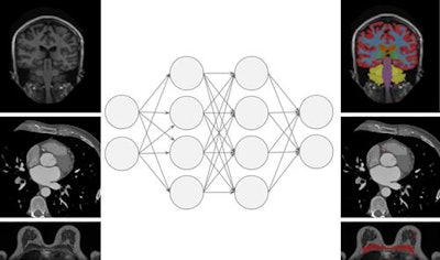 This figure shows an abstraction of work done on multitask learning for brain MR segmentation, cardiac CT segmentation, and breast MR segmentation (based on https://link.springer.com/chapter/10.1007/978-3-319-46723-8_55). The authors found that training a network to jointly perform these tasks did not affect its performance on any individual task. This may be a stepping stone toward a single system that can perform multiple tasks in medical image analysis.