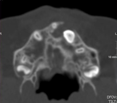 Axial CT scan