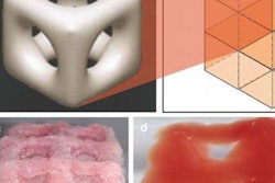 2018 01 12 19 52 0511 3d Printed Tissue Scaffold 20180112195936
