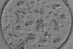 2018 01 18 18 42 2988 2014 11 21 Medphysweb Microbubble Fig2 Thumb
