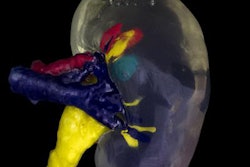 2018 01 19 17 37 4325 2018 01 22 3 D Printed Kidney 20180119173202