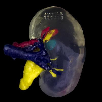 2018 01 19 17 37 4325 2018 01 22 3 D Printed Kidney 20180119173202