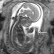2018 01 30 16 59 9413 2018 01 30 Mri Insider Thumb