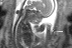2018 01 30 16 59 9413 2018 01 30 Mri Insider Thumb