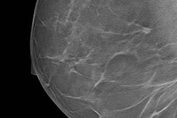 2018 02 01 21 25 7845 2018 02 02 One View Dbt Pic 20180201215409