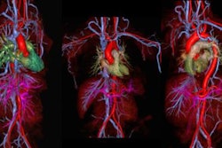 2018 02 02 17 19 4716 2018 02 03 Mra Claustrophobic 20180202173635