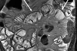 2018 02 06 17 10 6369 2018 02 06 Amme Thumb