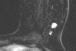 2018 02 15 22 16 9059 2018 02 16 Missed Mri Pic 400