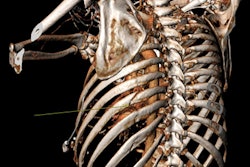 2018 02 24 00 20 6722 2018 02 28 3 D Thumb