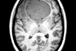 2018 02 26 20 05 9156 2018 02 27 Incidental Findings Thumb