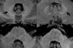 2018 02 27 00 16 3594 2018 02 28 Gadolinium 20180227001452