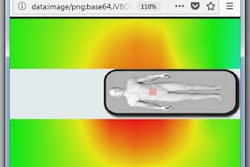 2018 03 01 06 15 2212 2018 03 01 Co De2 Thumb