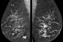 2018 03 02 23 53 4440 2018 03 03 Breast Thumb