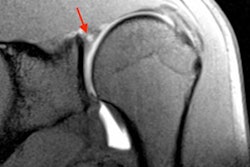 2018 03 03 00 06 1077 2018 03 03 Sport Mri 20180303001846