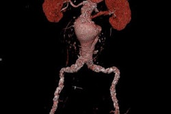 2018 03 03 21 33 6668 Sf17b Fig 1c 20180303214227