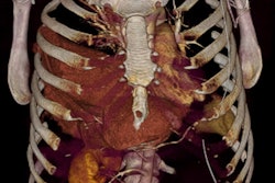 2018 03 03 21 33 6946 2018 03 04 Polytrauma2 Thumb