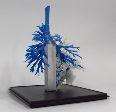 Detailed information about the human body can now be shown in 3D models. All images courtesy of Michael Richard, Liverpool Heart and Chest Hospital, and 3D LifePrints.