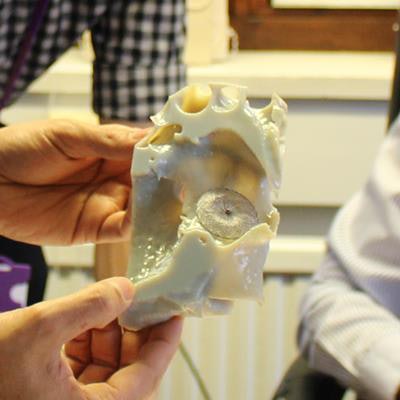 Trials are currently taking place on heart models for 25 adults with atrial septal defects who are to receive implanted devices.