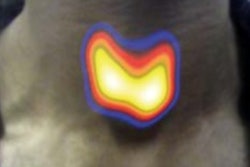 2018 03 14 18 10 5817 2018 03 15 Gamma Cam Thumbjpg