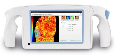 The HyperView imaging system. Image courtesy of HyperMed Imaging.