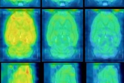 2018 04 03 17 21 4700 Pet Ligand Rat Dementia 20180403170249