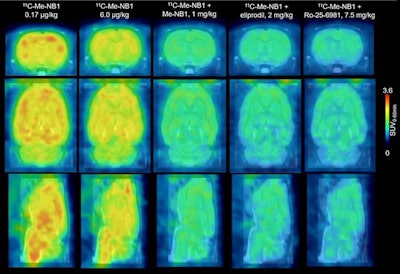 PET imaging of a rat's brain with C-11 Me-NB1 superimposed on an MRI template. Image courtesy of SNMMI and Krämer et al from ETH Zurich.