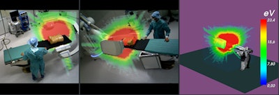 By combining graphics processing unit (GPU)-accelerated Monte Carlo simulations with color-coded augmented reality visualizations, the global radiation awareness system makes visible the propagation and intensity of scattered radiation for the current C-arm configuration and imaging parameters. Such a system has the potential to be used to teach intuitively about radiation's diffusion effects and about the best radiation safety practices through in situ visual feedback of radiation exposure. All images courtesy of Nicolas Loy Rodas, PhD, 'Context-Aware Radiation Protection for the Hybrid Operating Room,' PhD Dissertation, University of Strasbourg, 2018.
