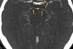 2018 04 09 20 50 2574 2018 04 10 Bmj Case Report Pix 20180410001202