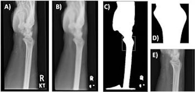2018 04 11 15 00 9938 2018 04 11 Machine Fig2 20180411151725