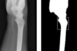 2018 04 11 15 48 1829 2018 04 11 Machine Thumb