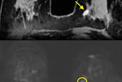 2018 04 11 19 15 0063 Mp Mri Dce Dwi Mri Insider 20180411193510