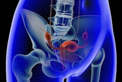 2018 04 19 18 26 2221 Uterus Pelvic 400