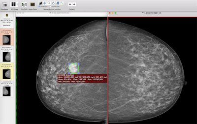 2018 04 24 16 15 7136 2018 04 24 Ii Insider Dl Cad1 20180424161941