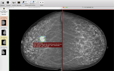 2018 04 24 16 15 7136 2018 04 24 Ii Insider Dl Cad1 20180424161949