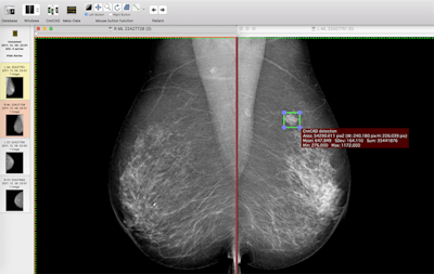 2018 04 24 16 15 7293 2018 04 24 Ii Insider Dl Cad2 20180424162046