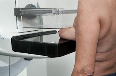 A mammography examination is performed at the Randers Regional Hospital. Photos courtesy of Sisse Helle Njor, PhD.