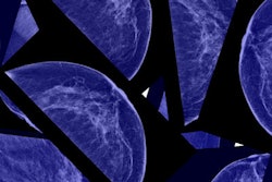 2016 08 26 11 32 34 470 Breast Mammo 400