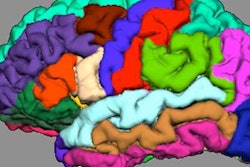 2018 04 25 21 05 6775 Cortical Folding 400