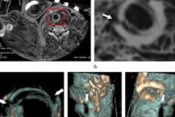 2018 04 30 22 35 0684 3 D Pmcta 20180430220546