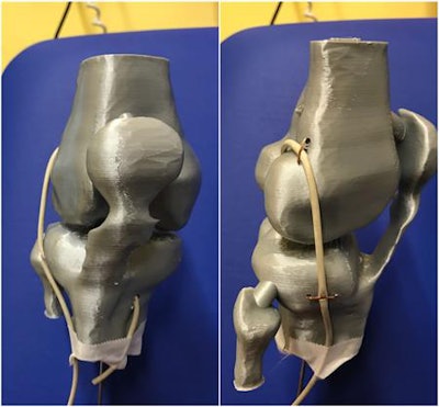 Frontal and lateral views of knee-printed model, with plastic cable positioned as a graft simulator according to Marcacci technique.