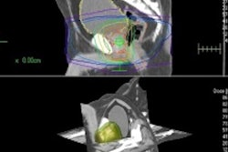 2018 05 07 21 11 2651 2018 05 08 Elekta Ai Medphysweb Thumb