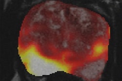 2018 05 11 18 45 6571 2018 05 14 Jnm Prostate Thumb