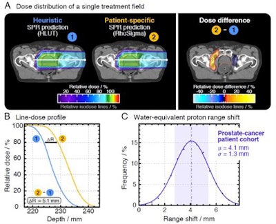 Differences between the HLUT and PIRP/DECT approach in a prostate patient (A, B). The range shift distribution in the whole prostate patient cohort (C). Credit: Patrick Wohlfahrt (OncoRay, HZDR).