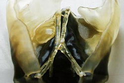 2018 05 24 18 54 5839 2018 05 28 3 D Printed Kidney Abdomen 20180524183834